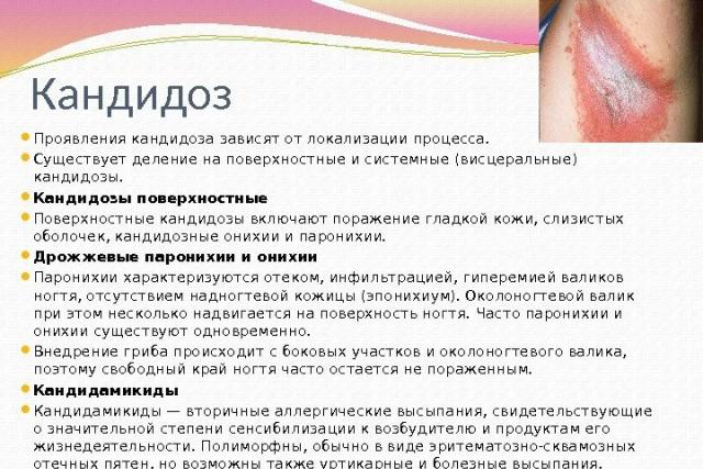Кондиломы - виды, причины, диагностика, лечение, удаление и профилактика Остроконечные кондиломы сами исчезли